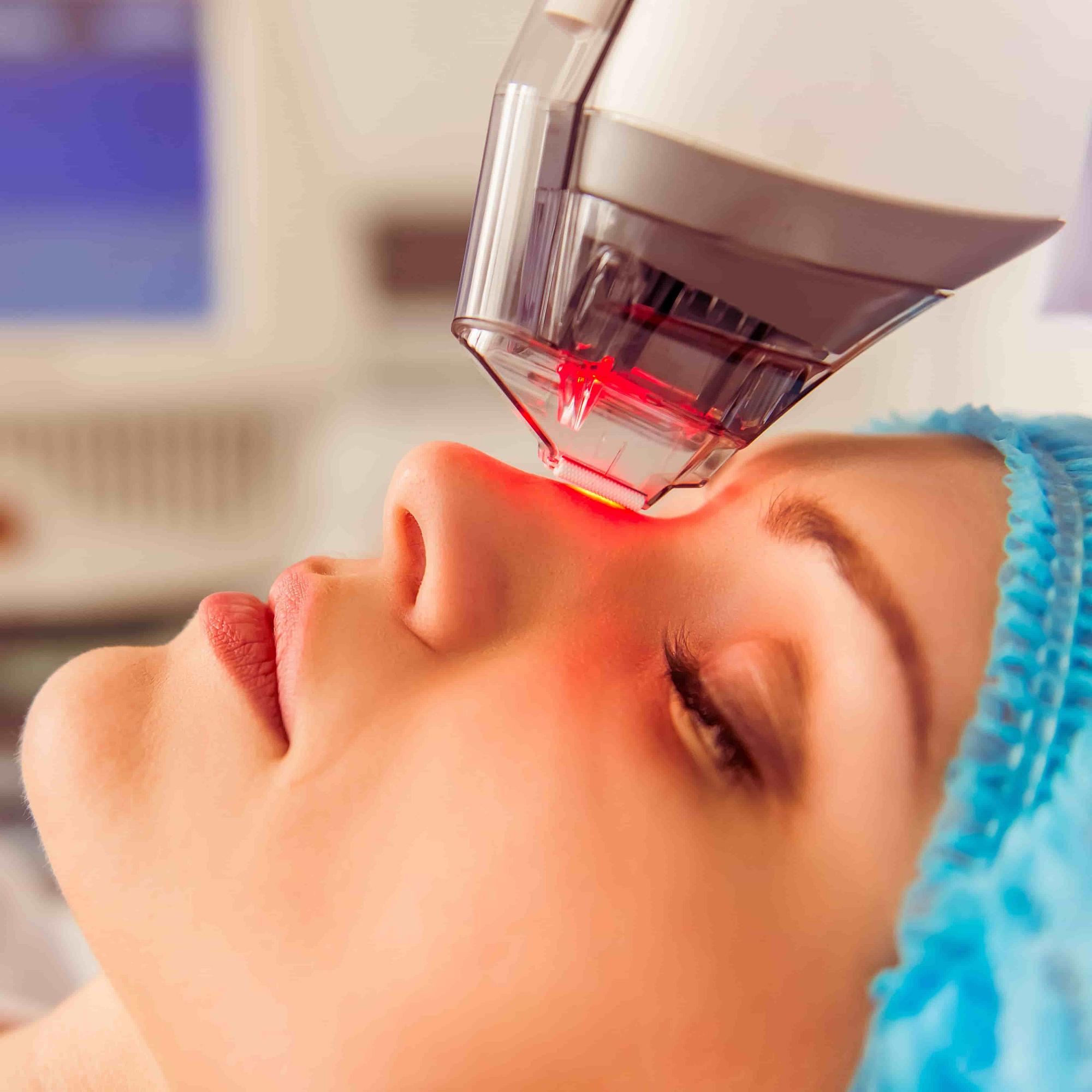The Three Types of Ablative Laser Treatments
